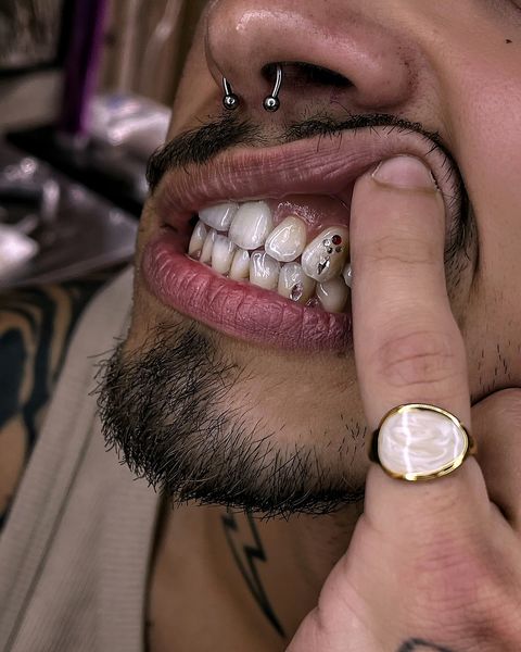 Gæst: Tooth gems 💎 og piercinger 💉 Tandbling af bg.mess