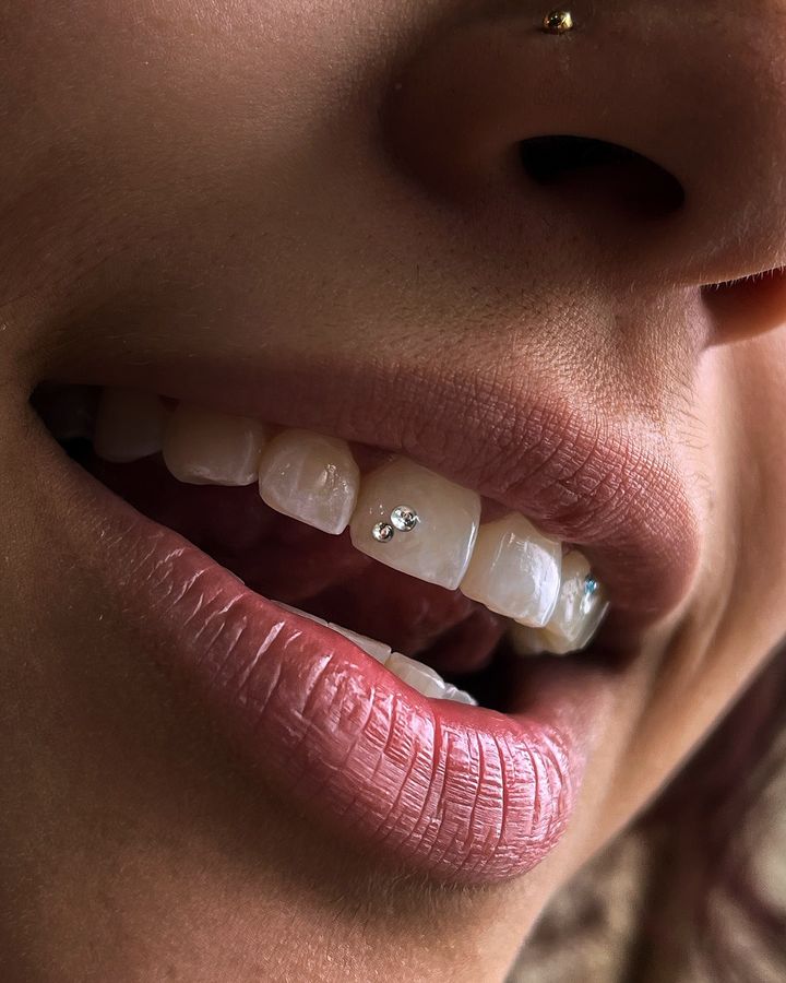 Tooth gem af @bg.mess