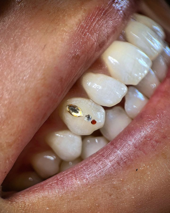 Tooth gem af @bg.mess
